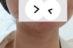 上海仁爱医院整形科好吗？有哪些成功案例？