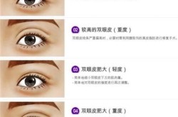 眼部整形手术的费用贵吗？眼部整形有哪些项目？