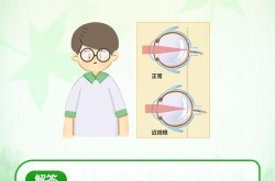 近视手术大概多少钱？安全性如何？