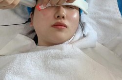 激光美容效果怎么样？有没有做过的人分享经验？