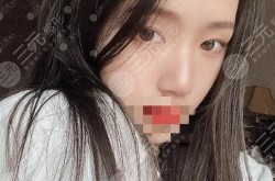 东大整形医院做鼻子怎么样？求专家推荐！