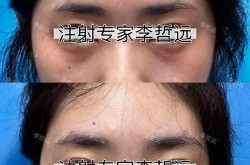 东方整形医美整形效果怎么样？求真实案例分享！