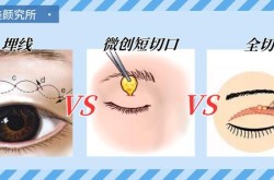 韩式微创双眼皮手术和传统方法比有哪些优势？