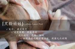 黑脸娃娃手术适合哪种肤质？有没有副作用？