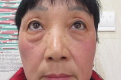 重庆超雅整形医院地址在哪里？特色项目有哪些？