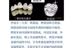 青岛烤瓷牙哪里做得好？价格是多少？