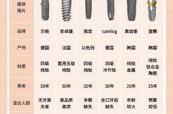 一颗种植牙的费用包括哪些？哪里种牙好？