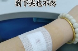 痣上长毛怎么办？可以彻底去除吗？