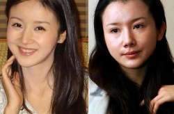 郑某整容前后变化大吗？明星整容有哪些风险？