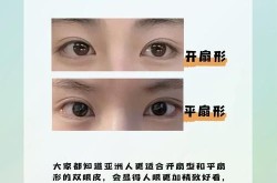 开双眼皮好的整形医院推荐，如何避免风险？