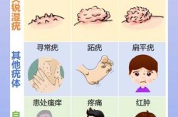 一夫一妻制下，如何感染hpv 男性（一夫一妻也会感染hpv病毒吗）