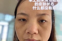 百莲凯去斑效果如何，有没有科学依据？