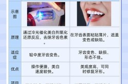 牙齿冷光美白价格和效果如何？有没有副作用？