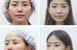 珠海博爱医院整形科评价如何？手术案例分享