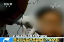 医疗整形美容有哪些风险？如何规避？