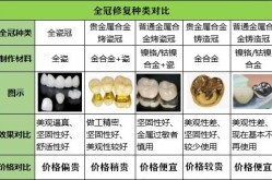 烤瓷牙的种类和价格有哪些？如何选择适合自己的烤瓷牙？