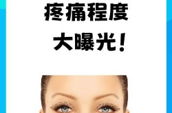 埋线整形是什么意思？有哪些优点？