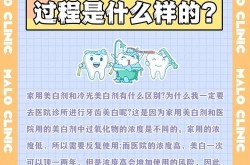 冷光美白剂真的安全有效吗？有哪些使用注意事项？
