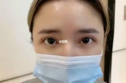 北京美联臣医院做双眼皮怎么样？求实例！
