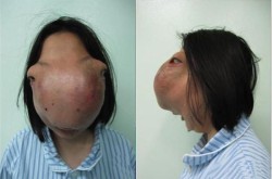 明星整形失败的案例有哪些？原因是什么？