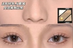塌鼻子变挺的方法有哪些？哪种最自然？