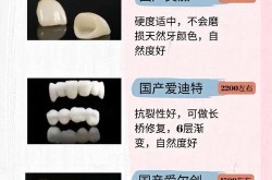 做烤瓷牙价格多少？使用寿命长吗？