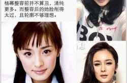 杨幂整形前后对比照，她整形了吗？