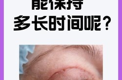 做韩式双眼皮手术要多少钱？效果可以维持多久？