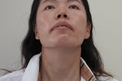 王蓉整容前后变化大吗？整形效果揭秘！
