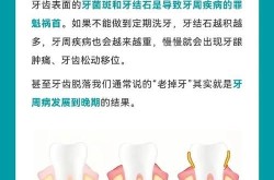 洁牙和洗牙的区别是什么？哪种更适合我？