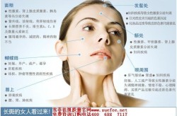 脸上的斑如何才能去掉？有哪些方法？