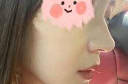 北京哪家鼻子整形医院技术最好？