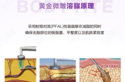 溶脂减肥哪家医院做得好？手术安全吗？