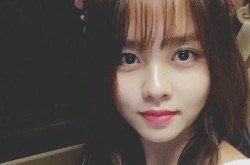 金所炫整容了吗？韩国女星整形前后大对比！