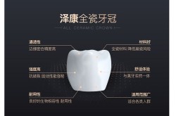 烤瓷牙套的价格大概是多少？使用寿命长吗？