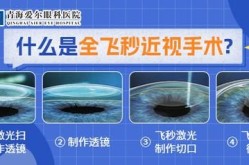 飞秒矫正近视医院哪家强？术后恢复需要注意什么？