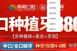昆山种植牙哪家医院做得好？价格大概是多少？