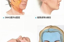全脸移植手术复杂吗？有哪些风险和挑战？