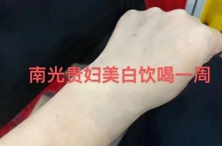 打美白针的价格和效果成正比吗？