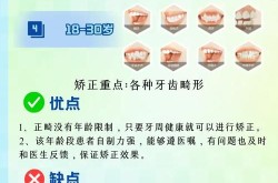 牙齿整形有没有年龄限制？如何选择合适的矫正方法？
