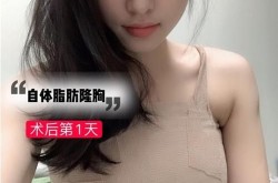 丰胸产品排行榜可信吗？哪个最有效？