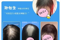 哪家植发医院技术更好？真实案例对比分析