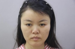 鼻子矫正手术复杂吗？效果可以维持多久？