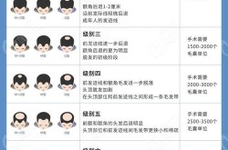 一根头发移植要多少钱？手术过程复杂吗？