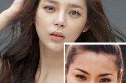 郑容和整容传闻是真是假？明星整形前后对比？
