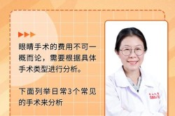 眼睛整形多少钱？常见问题解答