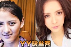 张予曦整容前后变化大吗？她的整形经历有哪些？
