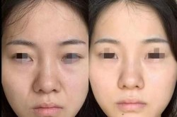 整形美容论坛哪个活跃？交流效果如何？