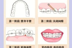牙齿校正的价格因人而异吗？一般要花多少钱？