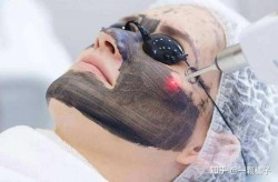 镭射黑脸娃娃有哪些注意事项？效果能维持多久？